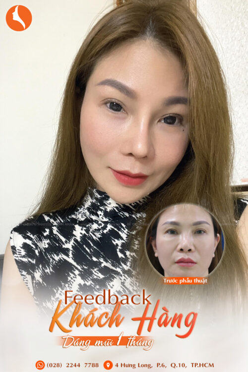 feedback khách hàng