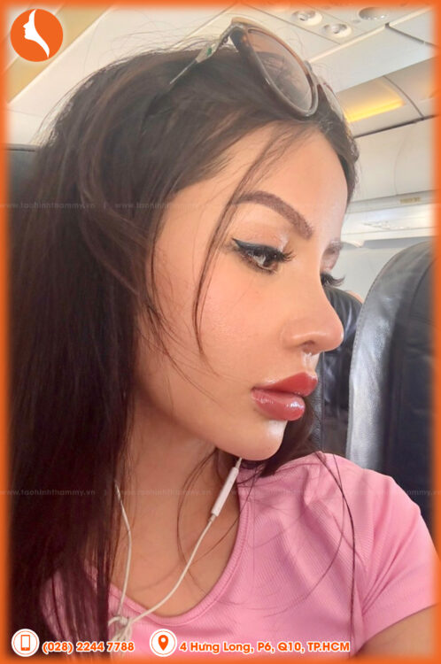 feedback khách hàng